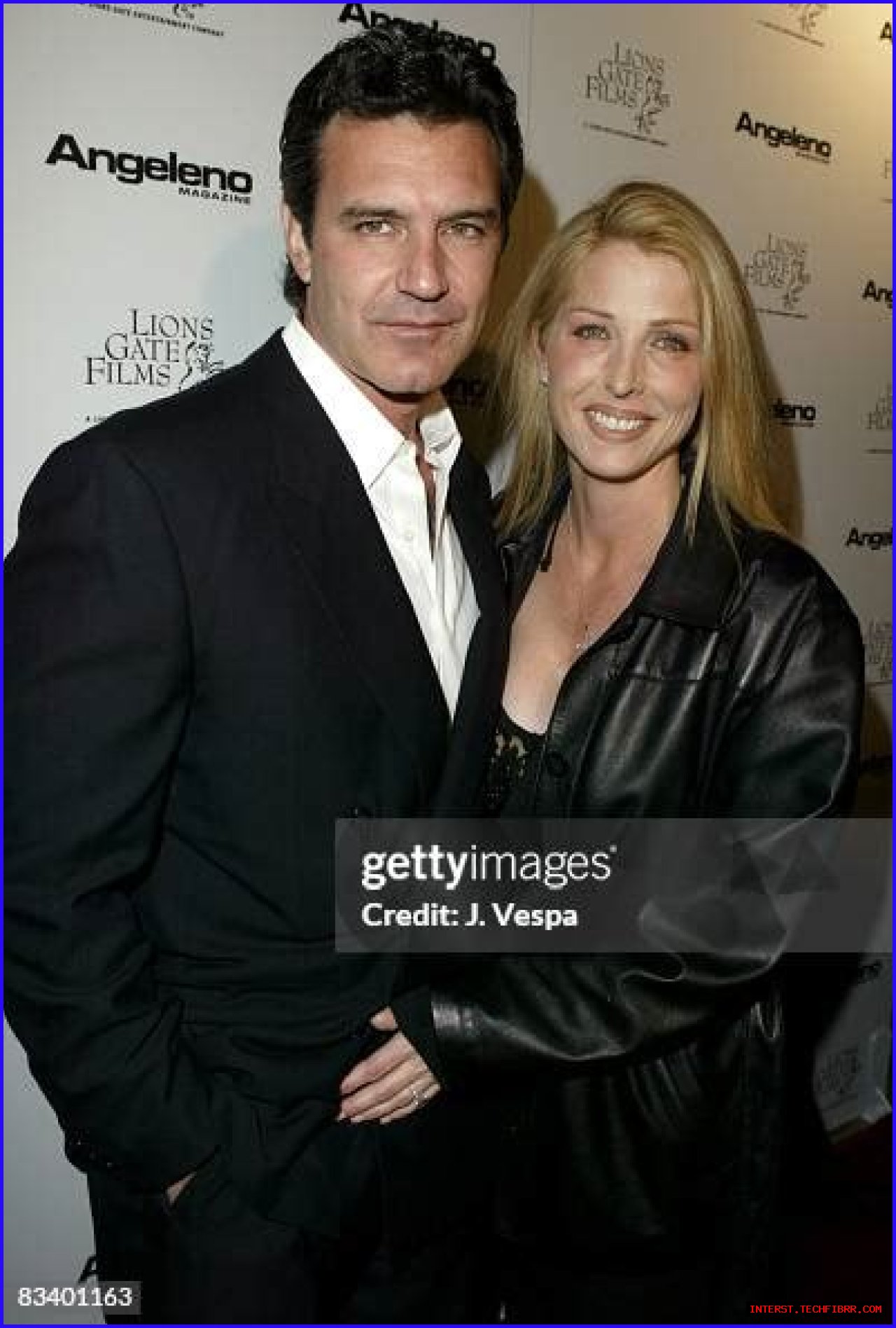 Unveiling The Inspiring Story Of Dr. Neal ElAttrache's Wife